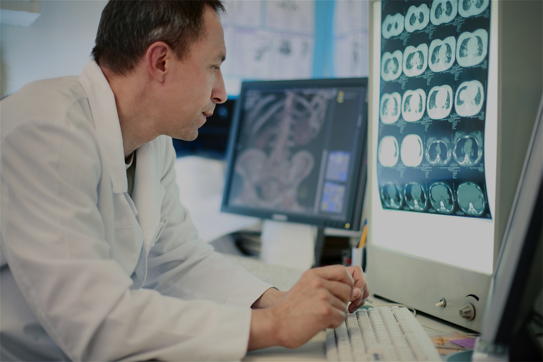 Image of a doctor looking at scans of a brain